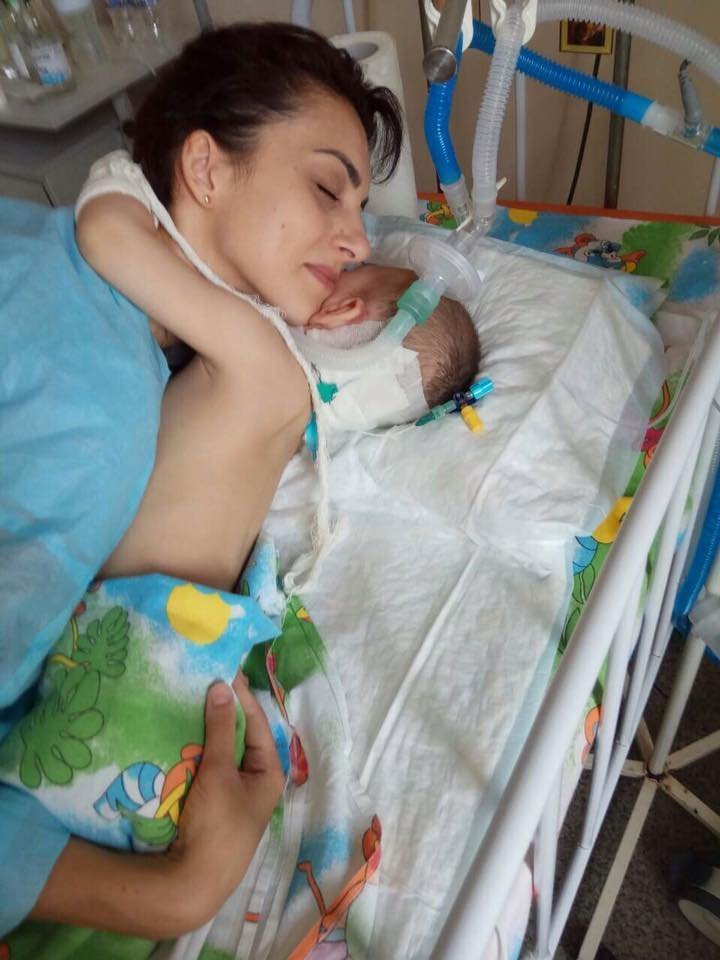 Маленький Артем Самко, у якого виявили пухлину мозку, терміново потребує допомоги Маленький Артем Самко, у якого виявили пухлину мозку, терміново потребує допомоги