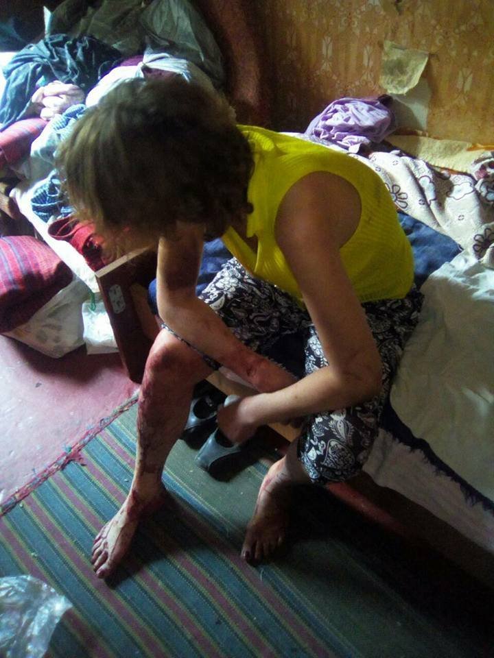 Кривава сварка співмешканців закінчилася госпіталізацією Кривава сварка співмешканців закінчилася госпіталізацією