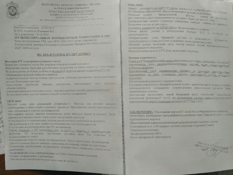 Якщо 14-річному Вадиму не замінити суглоб - ногу ампутують Якщо 14-річному Вадиму не замінити суглоб - ногу ампутують