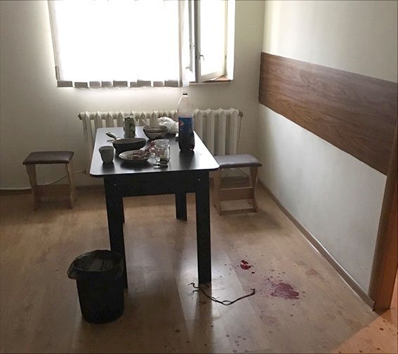 Кременчужанину запалом гранаты оторвало пальцы Кременчужанину запалом гранаты оторвало пальцы