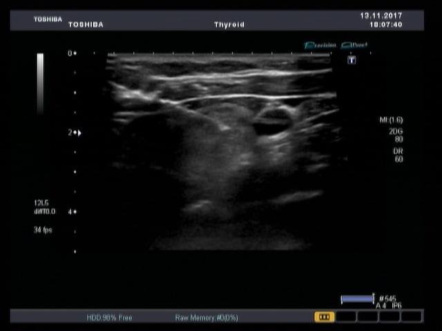 Медицинский центр семейного здоровья запустил в работу новейший ультразвуковой сканер экспертного класса Аплио Медицинский центр семейного здоровья запустил в работу новейший ультразвуковой сканер экспертного класса Аплио