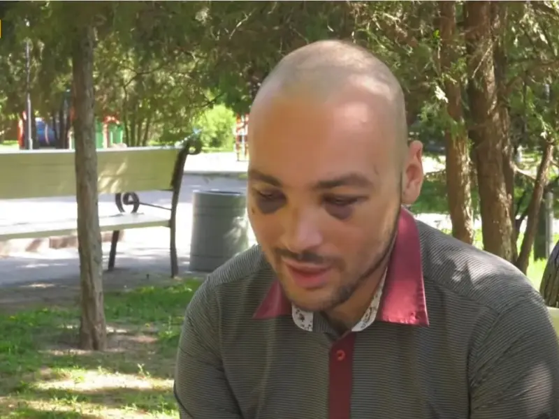<span class="custom-bold">«Били до крові та цинічно голили налисо»: у Полтаві група підлітків напала на юнака</span> <img src="https://www.telegraf.in.ua/wp-content/uploads/2026/03/video.svg" alt="" class="feed-icon" style="width: 20px; height: 20px; vertical-align: middle;" />